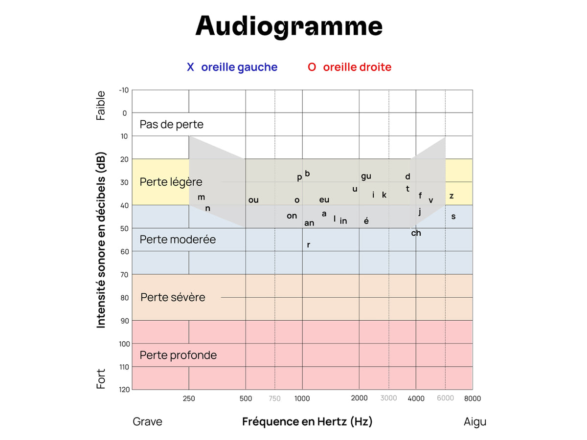 Audiogramme tonal - main